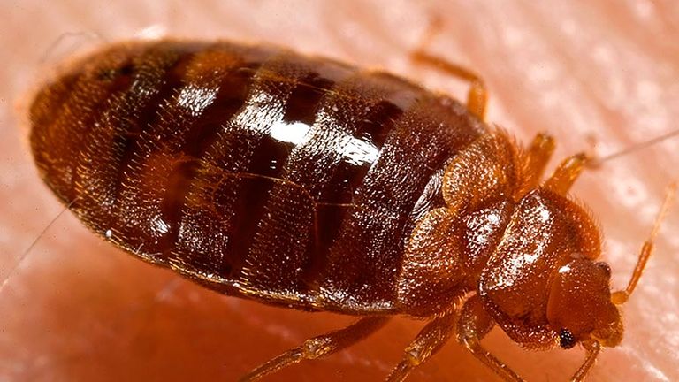 Lateral view of an adult bedbug, Cimex lectularius, as it was in the process of ingesting a blood meal from the arm of a voluntary human host. Photo dated 2006.